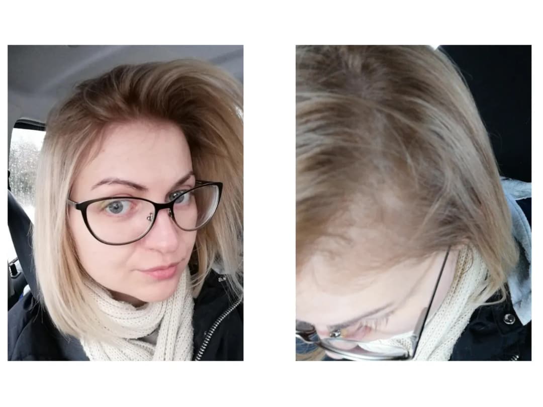 Skuteczne sposoby na włosy blond bez żółtego odcienia - najlepsze metody