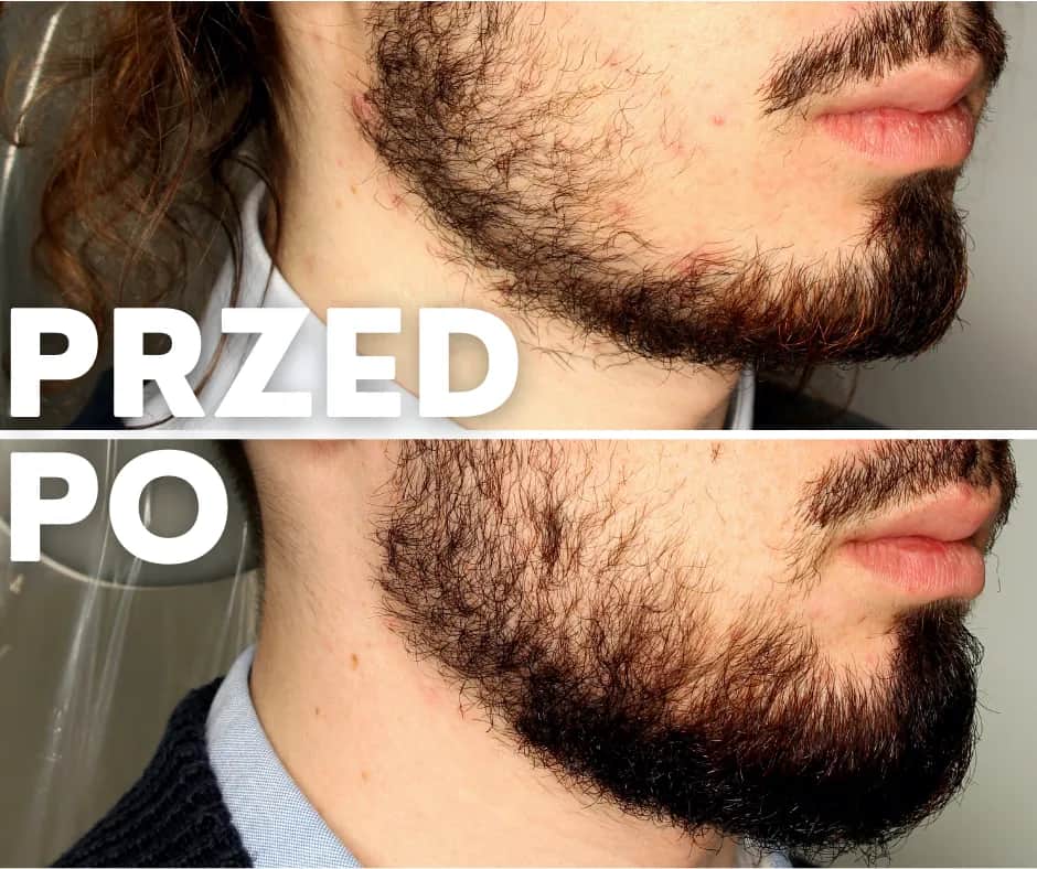 Jak pielęgnować rzadką brodę? Oto olejki, wcierki i cała pielęgnacja