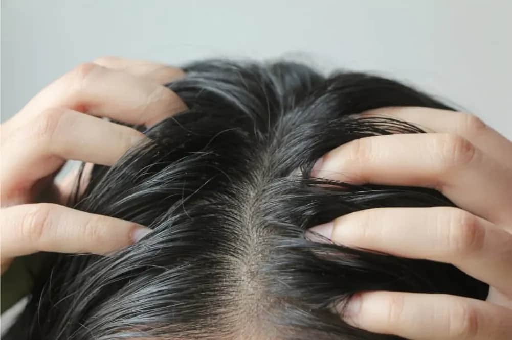 Dlaczego włosy szybko się przetłuszczają i wypadają? Poznaj skuteczne metody