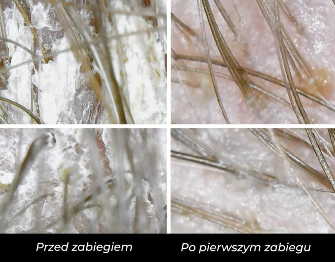 Jak prawidłowo wykonać peeling skóry: kompletny poradnik dla każdego