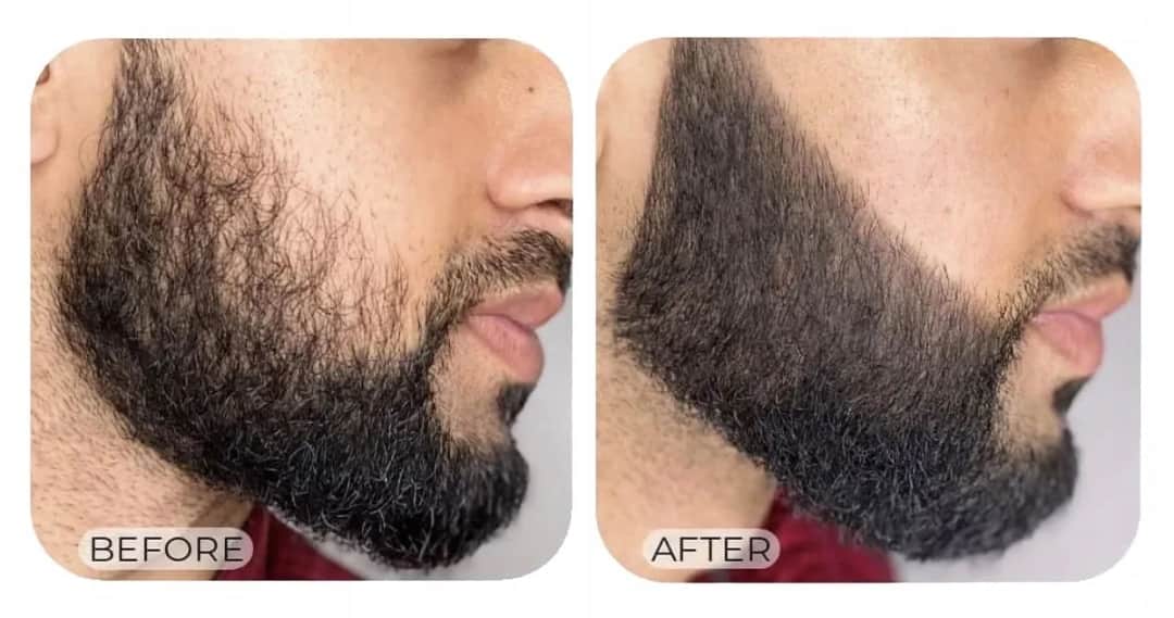 Konturowanie brody? Oto 5 trików na idealny kształt ostry jak brzytwa